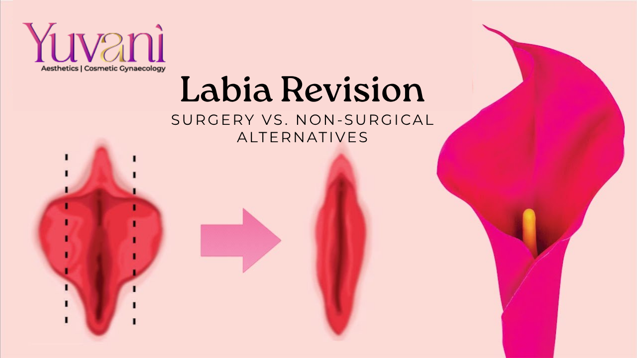 Labia Revision Surgery vs. Non-Surgical Alternatives: Which Option Is Best?
